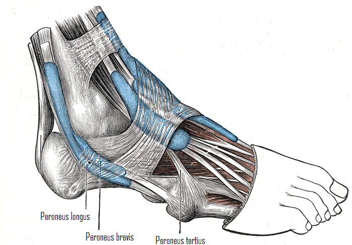 Peroneal on sale tendon tear